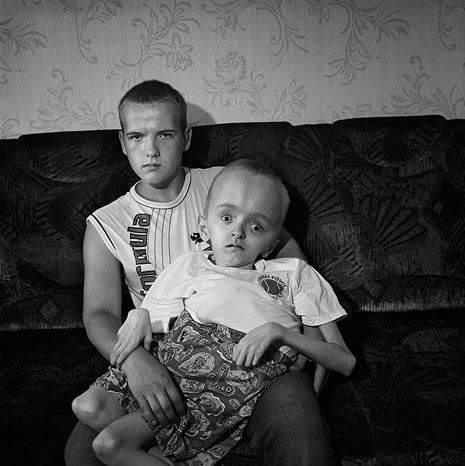 chernobyl-victims